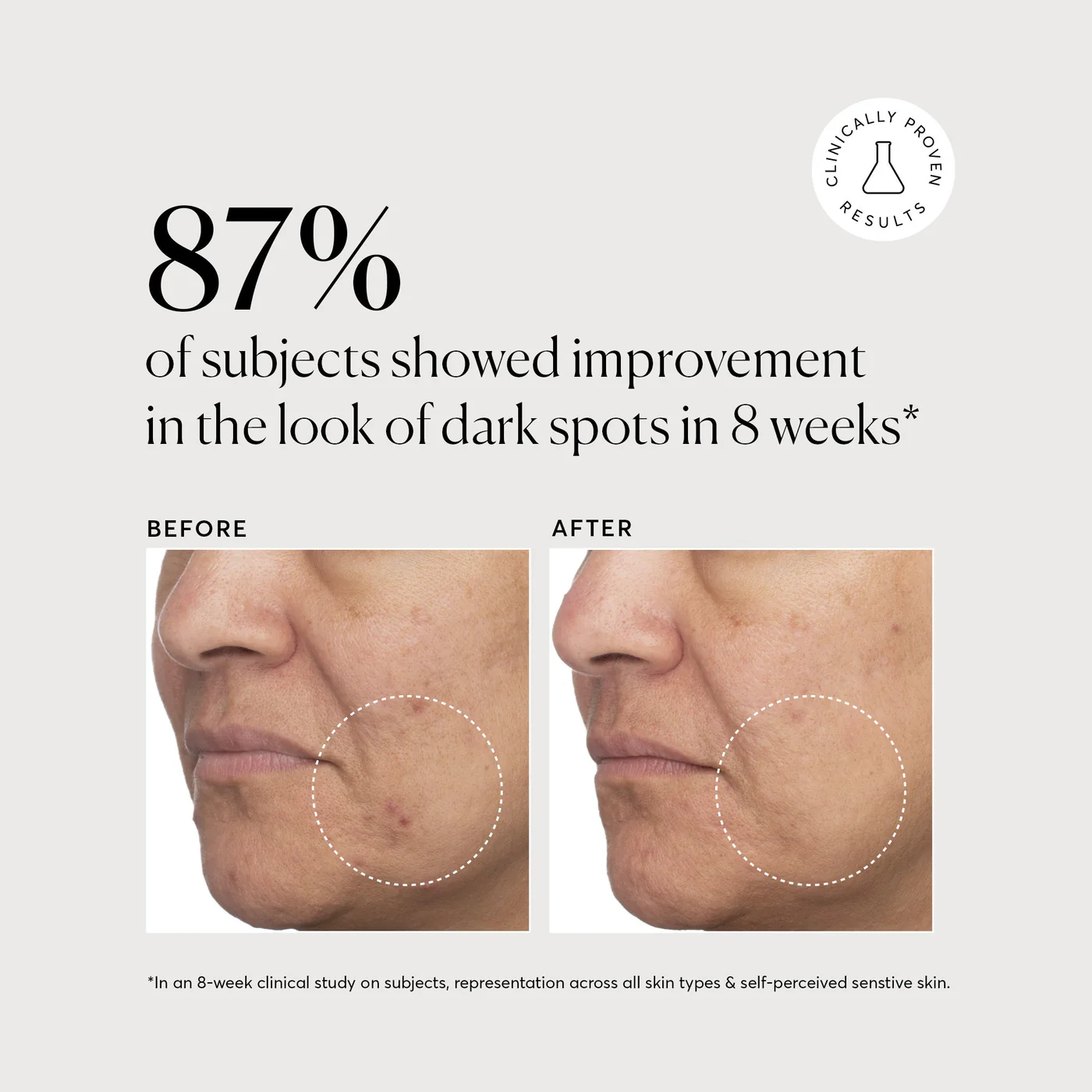 Naturium Tranexamic Acid